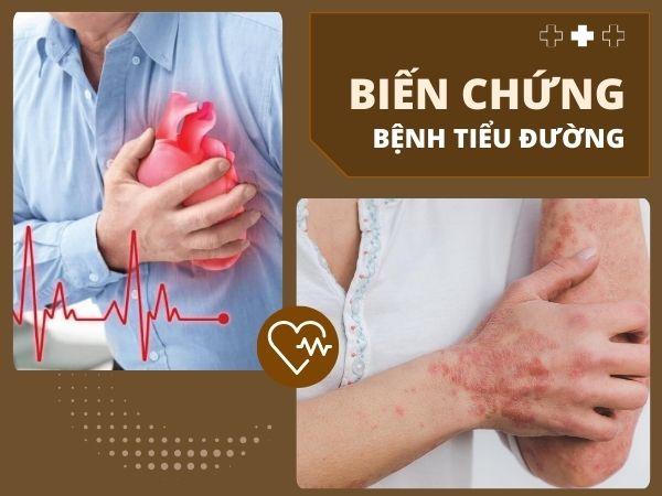 Bệnh tiểu đường là gì? Nguyên nhân, dầu hiệu và hậu quả 